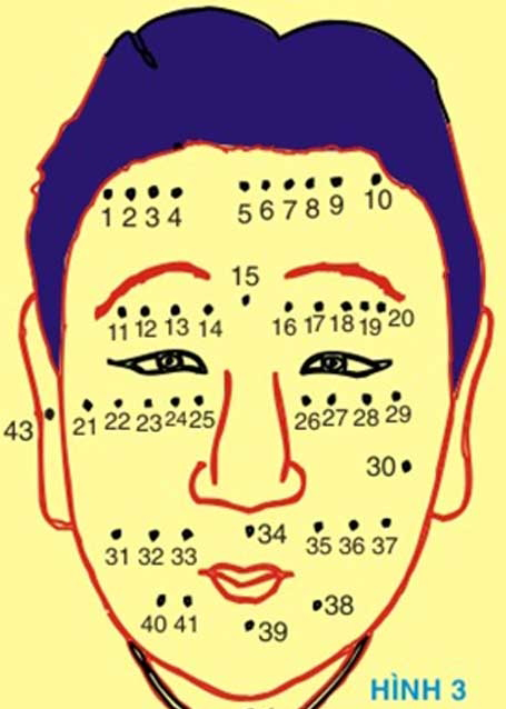Tổng hợp các ý nghĩa của nốt ruồi trên khuôn mặt nam giới và nữ giới