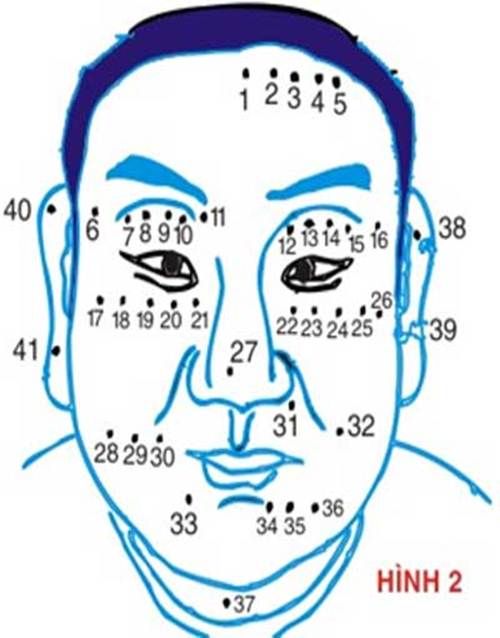 Ý nghĩa các vị trí nốt ruồi trên khuôn mặt đàn ông