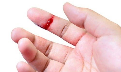 Mơ thấy đứt tay chảy máu là điềm gì, tốt hay xấu? Vansu.net
