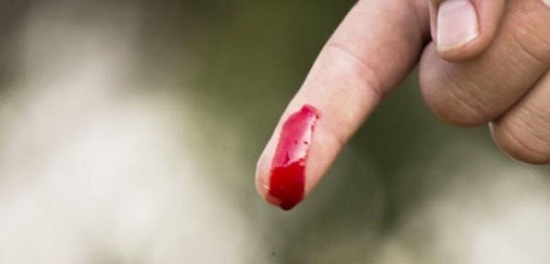 Đứt tay chảy máu: Luận giải điềm báo tốt xấu và con số may mắn