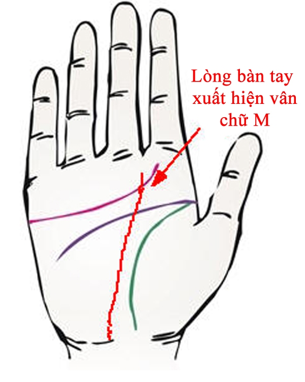 Cách đơn giản để nhận biết đường chỉ tay xuất ngoại là vân chữ M trên lòng bàn tay